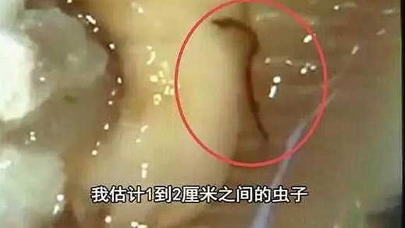 一只生蠔引起的冤案，觸動(dòng)了餐飲人的“麻木神經(jīng)”